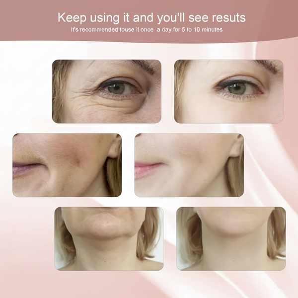 Face Lifting Massage Device