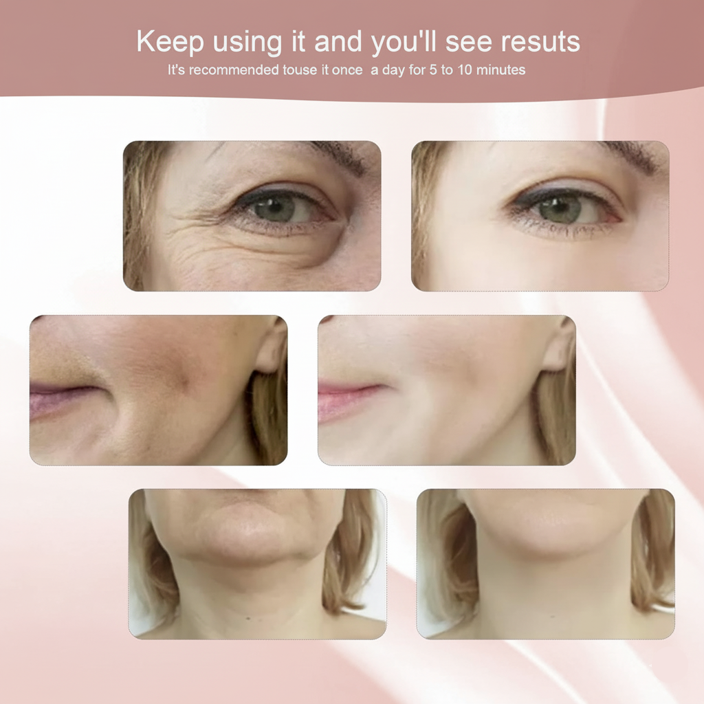 Face Lifting Massage Device