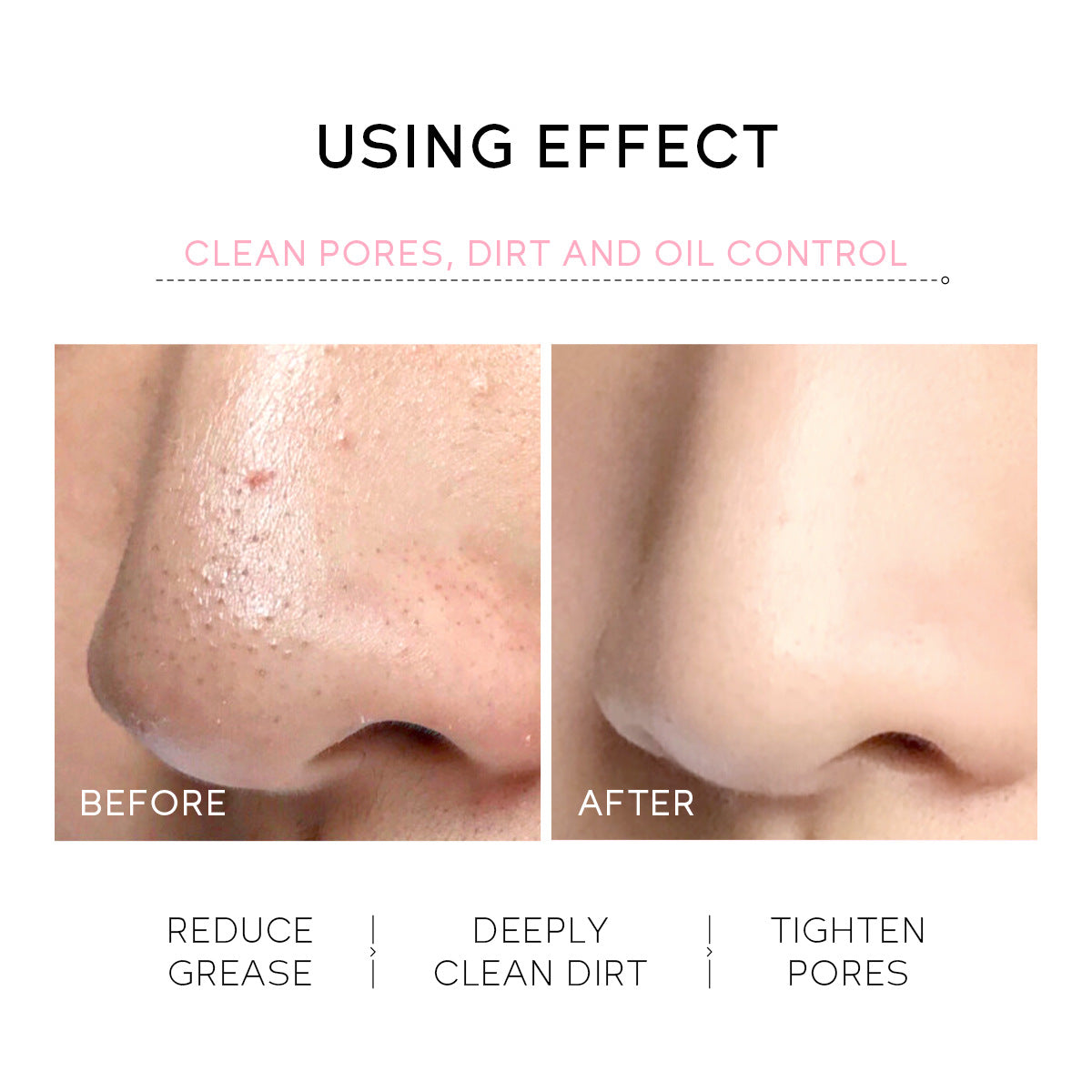 Peel-Off Nose Mask 30g