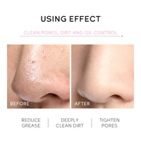 Peel-Off Nose Mask 30g