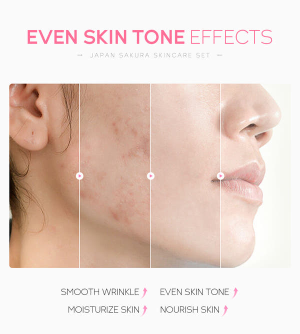 6 Pieces Super Gift Set - Sakura Cherry Blossom Skincare Set