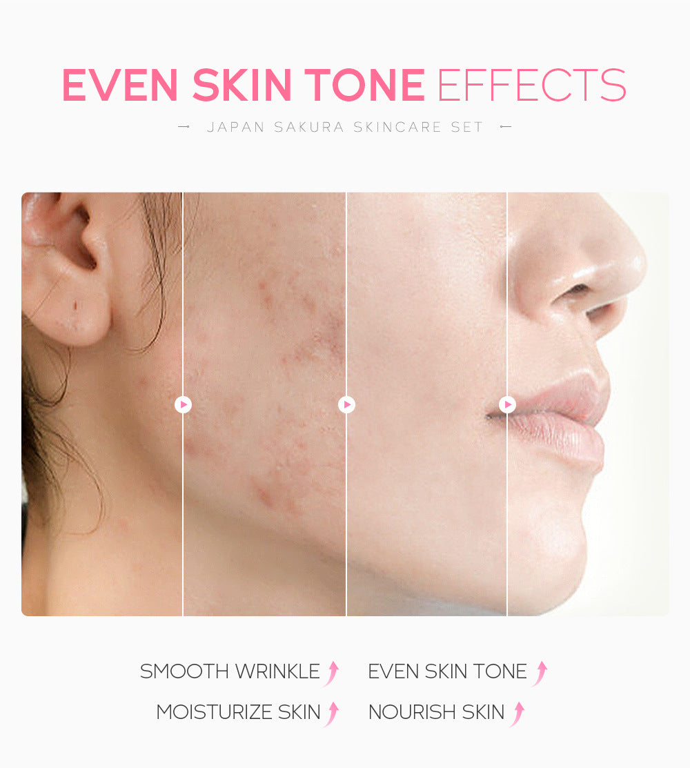 6 Pieces Super Gift Set - Sakura Cherry Blossom Skincare Set