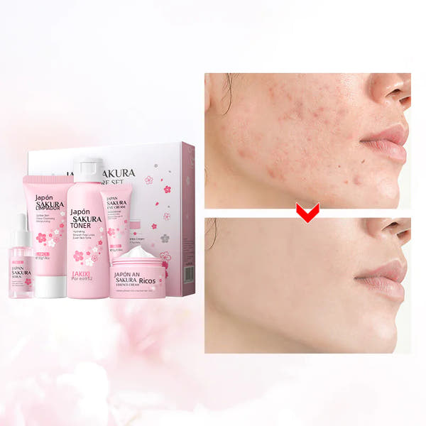 5 Pieces Gift Box - Sakura Cherry Blossom Skincare Set